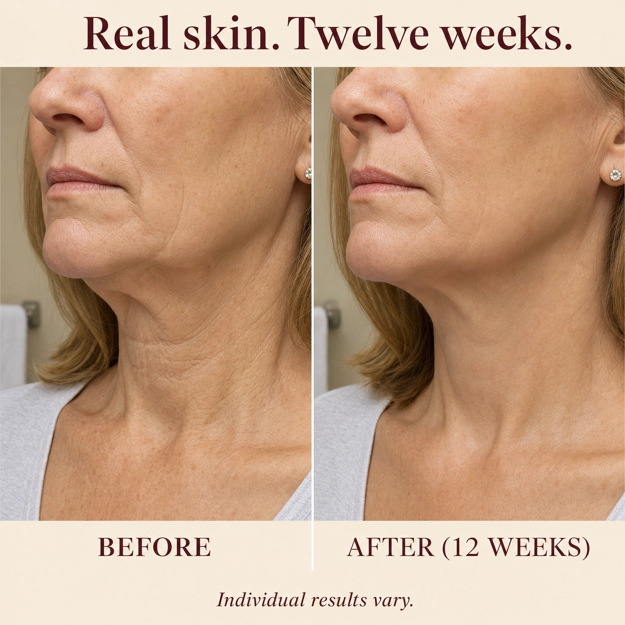 Zelora Snap-Back Serum™
