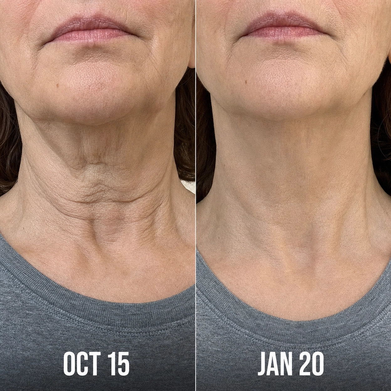 Zelora Snap-Back Serum™